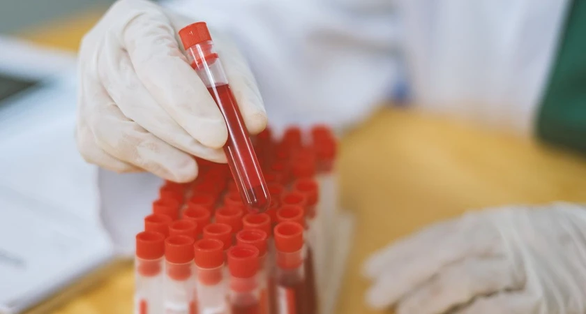 Scientifique manipulant un échantillon de sang en laboratoire.