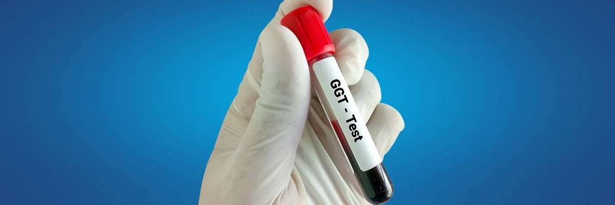 Tube de prélèvement sanguin pour test GGT tenu par une main gantée sur fond bleu.