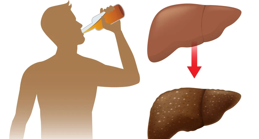 Consommation d'alcool et effet sur le foie, avant et après consommation.
