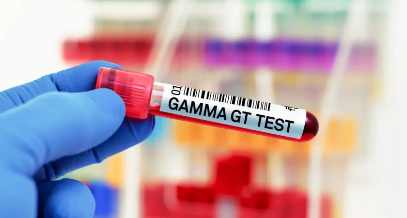 Tube de test sanguin étiqueté "Gamma GT" tenu par une main gantée.