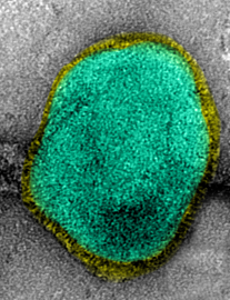 un métapneumovirus vu en microcopie électronique