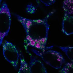 Image de macrophages (bleu) infectés par Brucella abortus (magenta) pendant 65 heures.