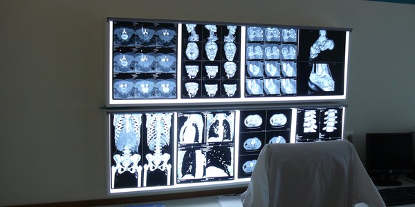 Das Bild zeigt eine Klinik oder ein Arztbüro mit einem Bildschirm, auf dem mehrere Röntgen- und CT-Bilder angezeigt werden. Im Vordergrund befindet sich ein weißer Arztkittel sowie ein Buch auf dem Tisch, während im Hintergrund ein Computer zu sehen ist.