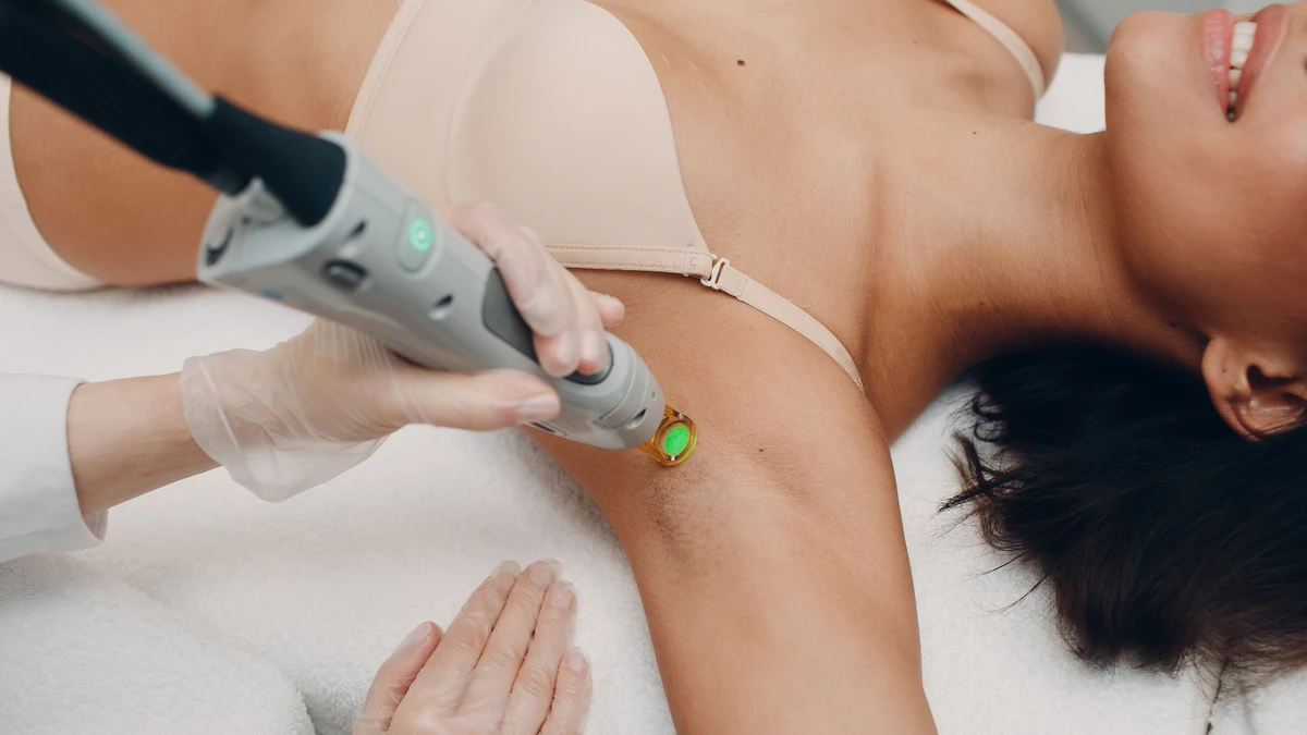 Épilation laser - aisselles 