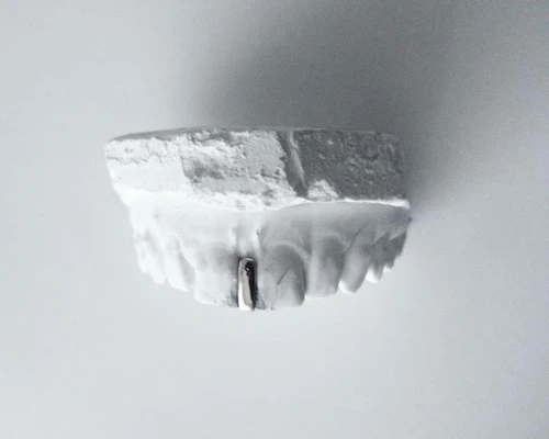 Grillz Chromatic Interstice (Argenté, Haut)